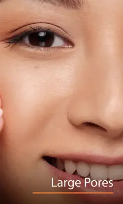 Large Pores