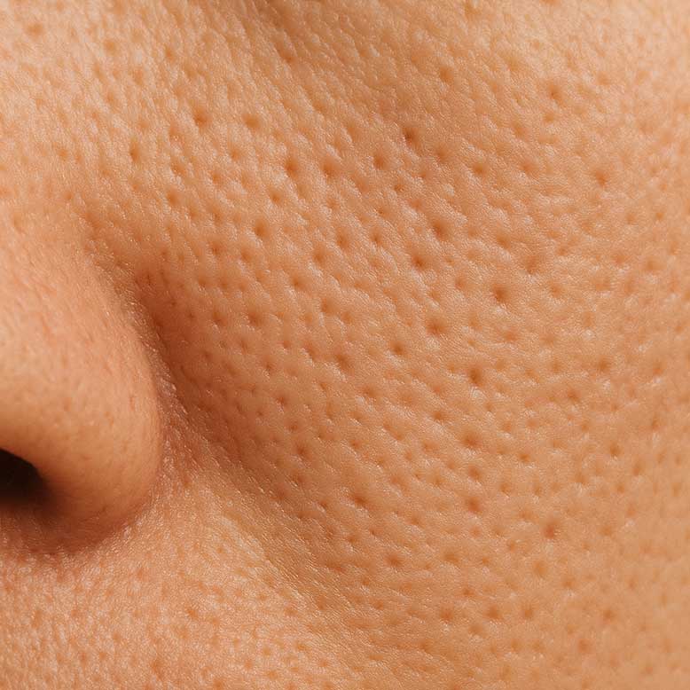 Pori-pori Besar? Mungkin Kamu Sering Lakukan Hal Sepele Ini!