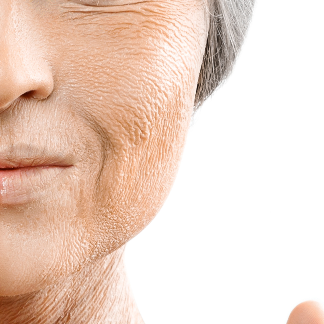 Keriput Muncul Duluan? Salah Kamu atau Faktor Genetik?