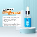 Acne Serum Eksotika